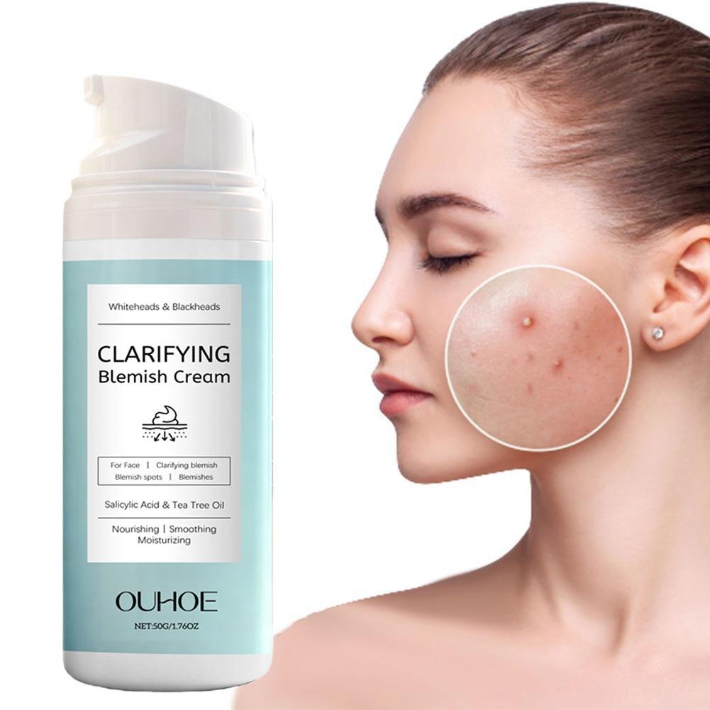 Salicylic Acid Blackhead Remover - كريم حمض الساليسيليك لإزالة حب الشباب،