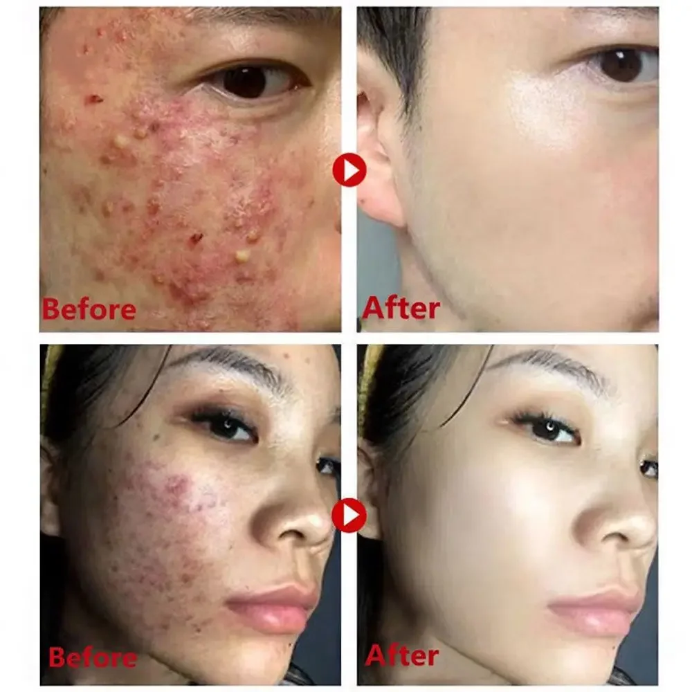 قناع الشاي الأخضر عصا إزالة ال - مراجعة Green Tea Cleansing Clay Mask وسعره